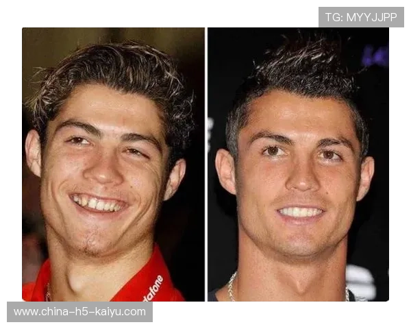 爆料被曝伤情加重,C罗或被迫临时引援 爆料被曝伤情加重,C罗或被迫临时引援